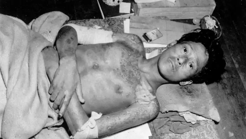 Nagasaki’den Gelen Uyarı: Nükleer Felaket Tehlikesi Yeniden Kapıda